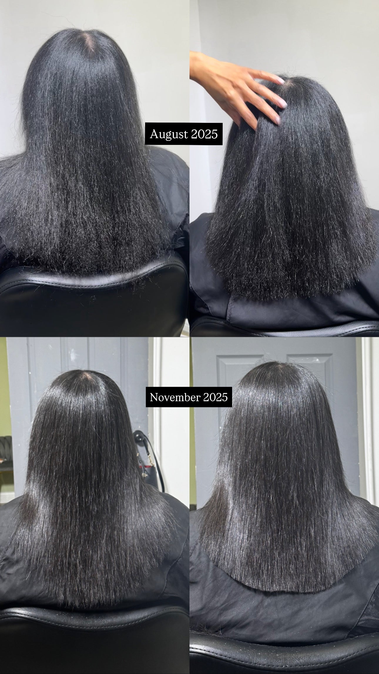 Amino Acid Smoothing Treatment