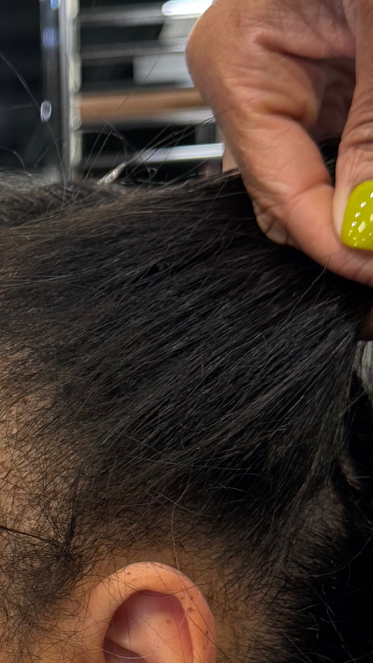 Fusion Invisible K-Tip Extension Service