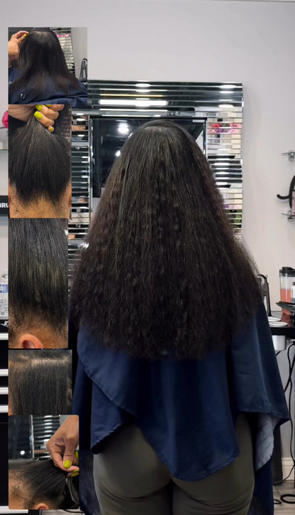 Fusion Invisible K-tip Extensions Consultation