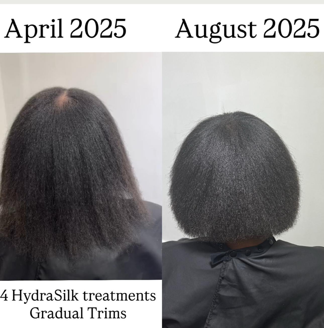 Hydra Treatment For Men