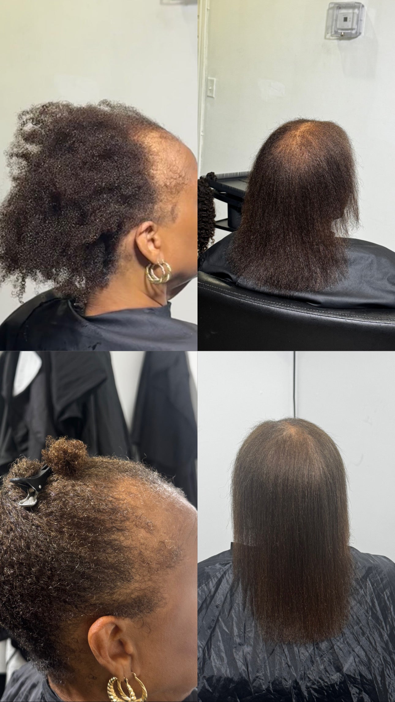 HydraSilk Hair Health Consultation